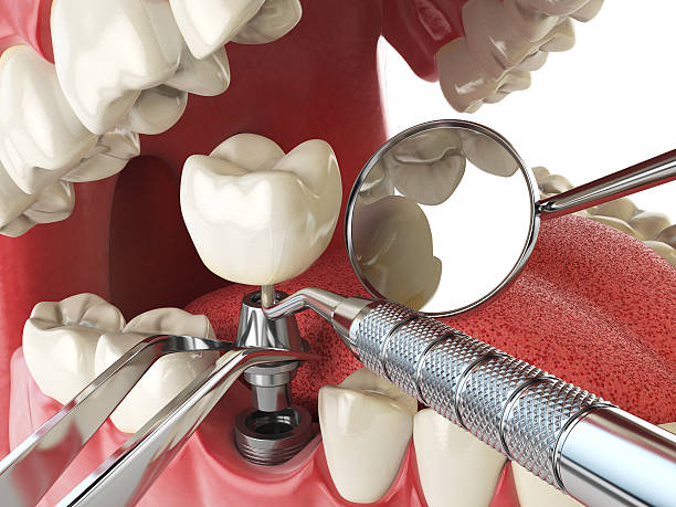 Best Knocked-Out Tooth Emergency  in , WY